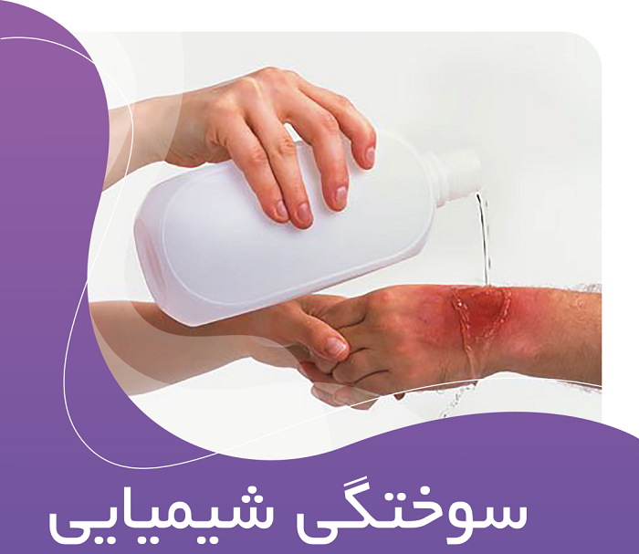 سوختگی بدن با مواد شیمیایی چگونه است