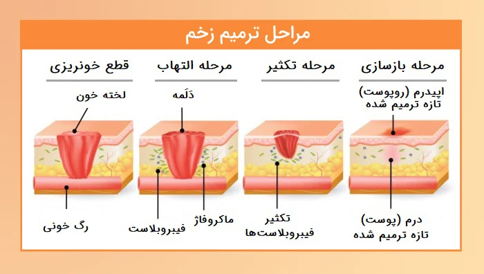 چگونه زخم بهبود پیدا می کند