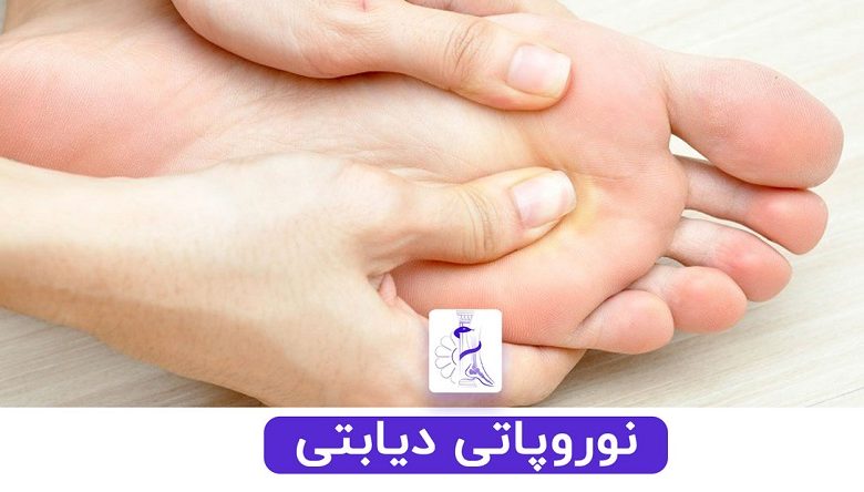 درمان نوروپاتی دیابتی توسط پزشک متخصص