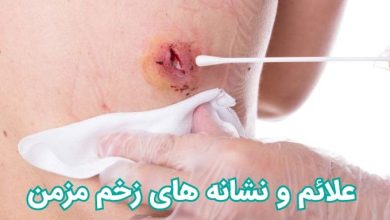 علائم و نشانه های زخم مزمن