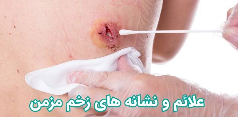 علائم و نشانه های زخم مزمن