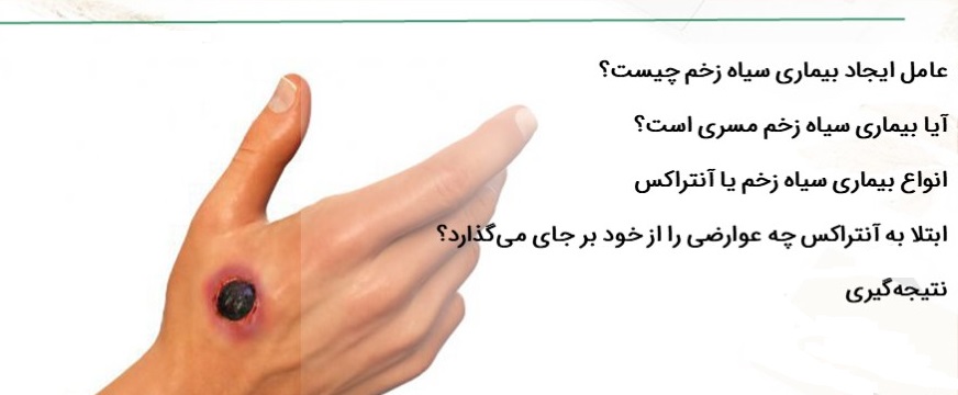 سیاه زخم چه عوارض مهمی دارد