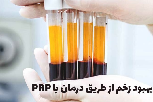 پلاسما درمانی زخم چیست و چه مزایایی دارد