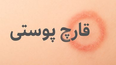 قارچ پوستی