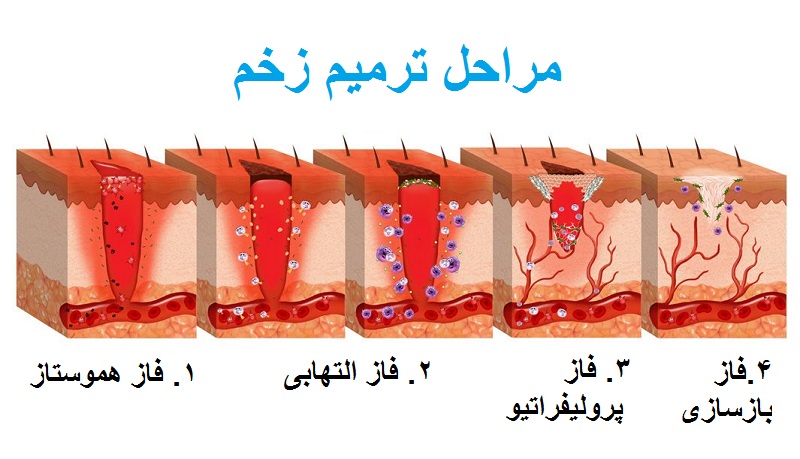 مراحل ترمیم زخم چگونه است