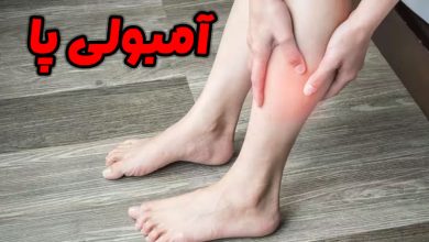 آمبولی پا