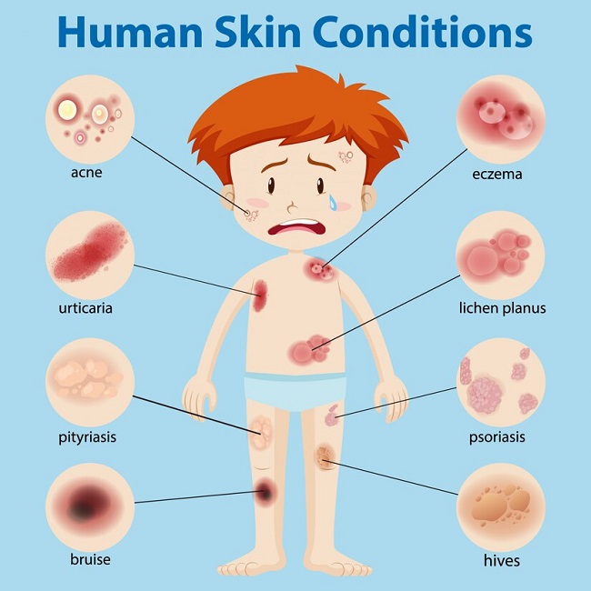 روش های تشخیص عفونت پوستی