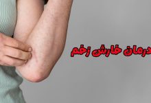 خارش زخم چیست و چه دلایلی دارد