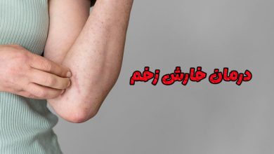 خارش زخم چیست و چه دلایلی دارد