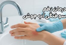 درمان زخم سوختگی آب جوش