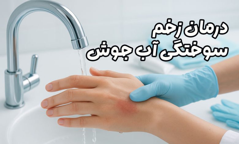 درمان زخم سوختگی آب جوش