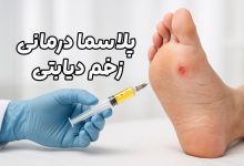 پلاسما درمانی زخم دیابتی