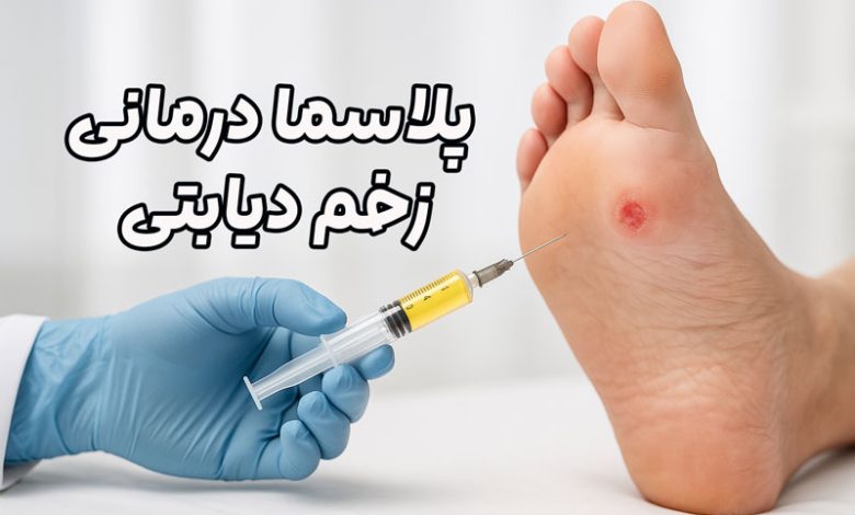 پلاسما درمانی زخم دیابتی