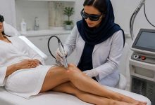 درمان رگ های واریسی با لیزر کوآنتا سیستم ایتالیا