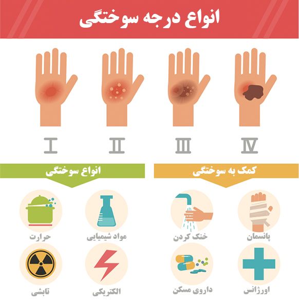 درجات سوختگی بدن کدامند 