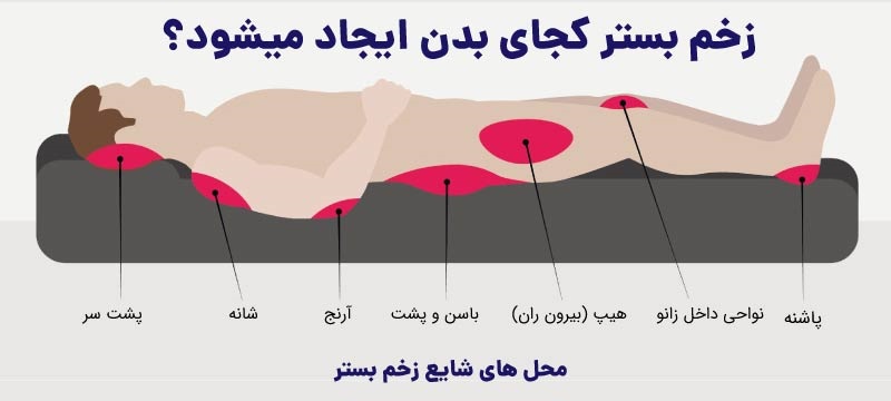 کلینیک تخصصی درمان زخم بستر