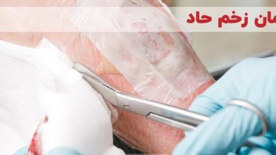 زخم حاد چگونه درمان میشود