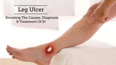 راه های تشخیص زخم روی پا