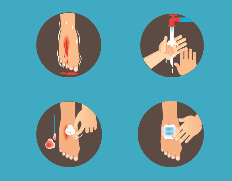 زخم عمیق چگونه درمان میشود