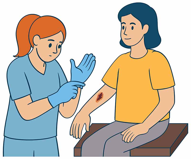 سیاه شدن جای زخم