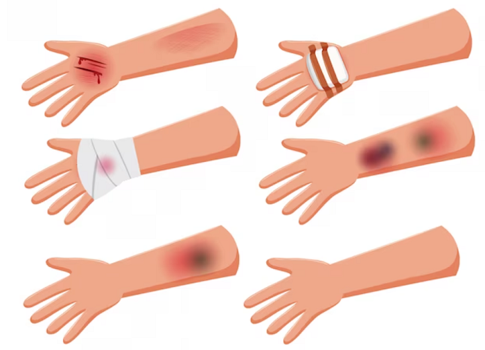 خدمات مراقبت از زخم چیست