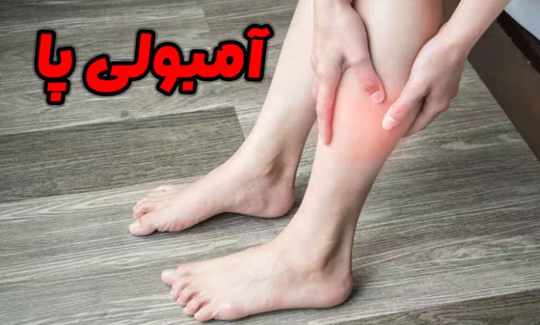 آمبولی پا