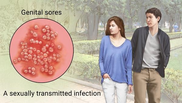 زخم تناسلی چه علائمی دارد