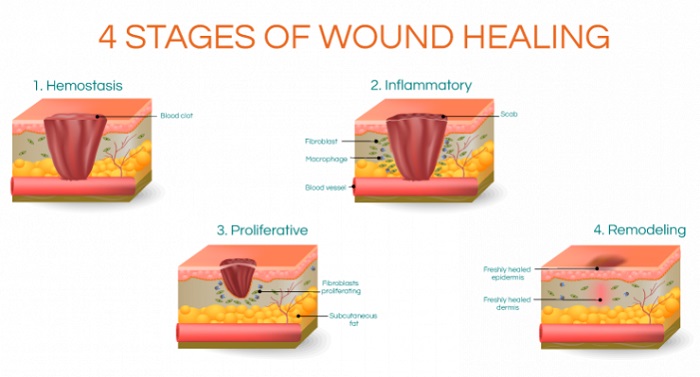 فیزیولوژی ترمیم کننده زخم و روش های انجام آن