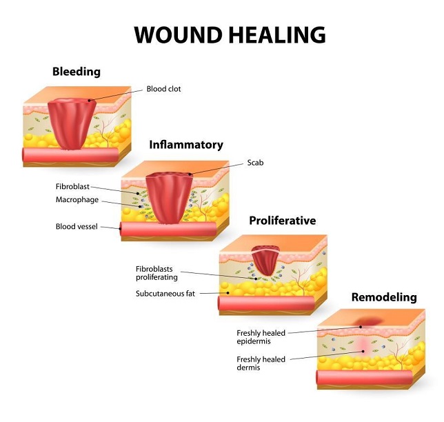 مکمل ترمیم کننده زخم چیست