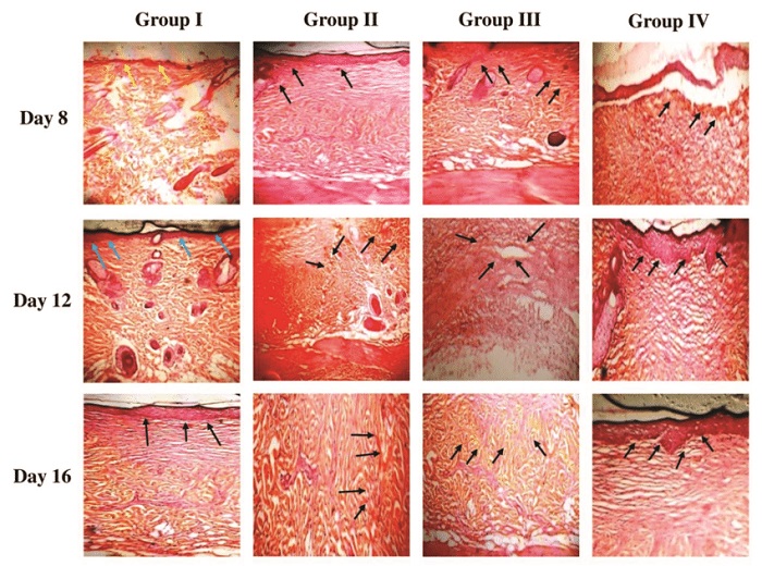 بافت-گرانوله-زخم