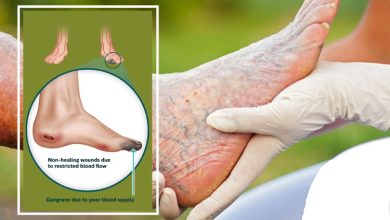 زخم ایسکمیک چه علائمی دارد