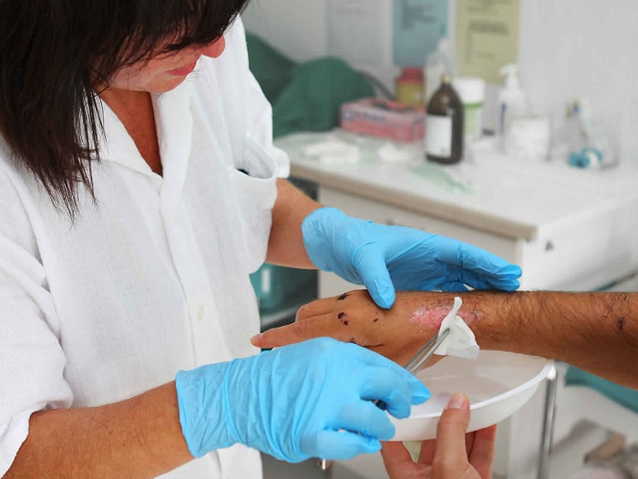 ماگوت تراپی چیست و انواع ان کدامند