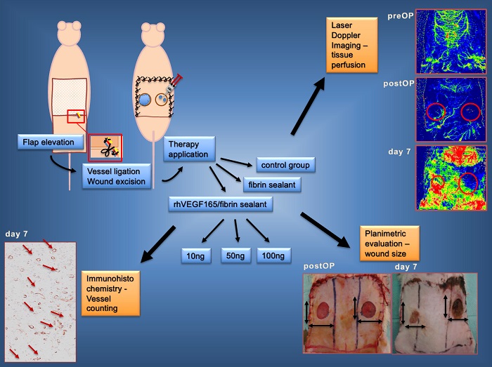 چه افرادی در معرض خطر زخم ایسکمیک هستند