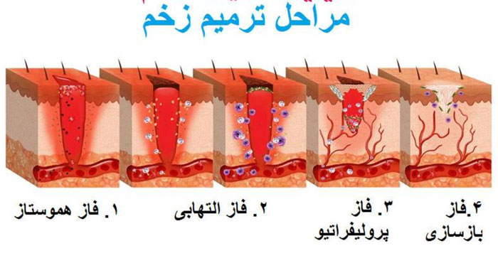 بافت گرانوله زخم در چند فاز تشکیل میشود ؟