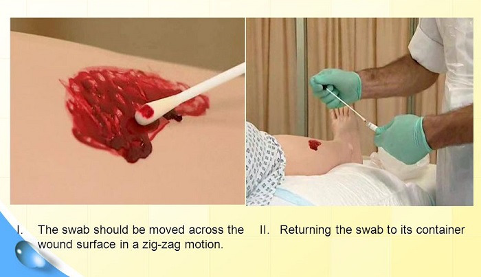 انجام کشت زخم چه اهمیت و مزایایی دارد