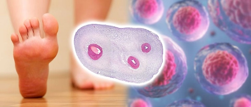 درمان سلولی زخم چیست