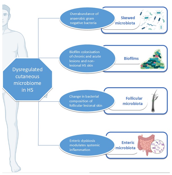 هیدرادنیت چرکی چگونه درمان می‌شود
