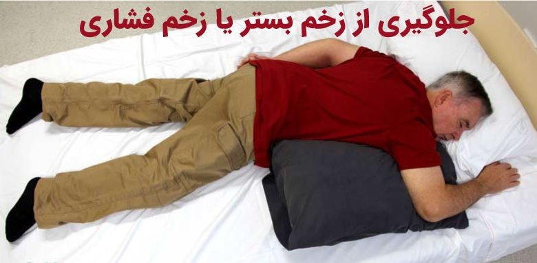 زخم فشاری چگونه تشخیص داده می شود