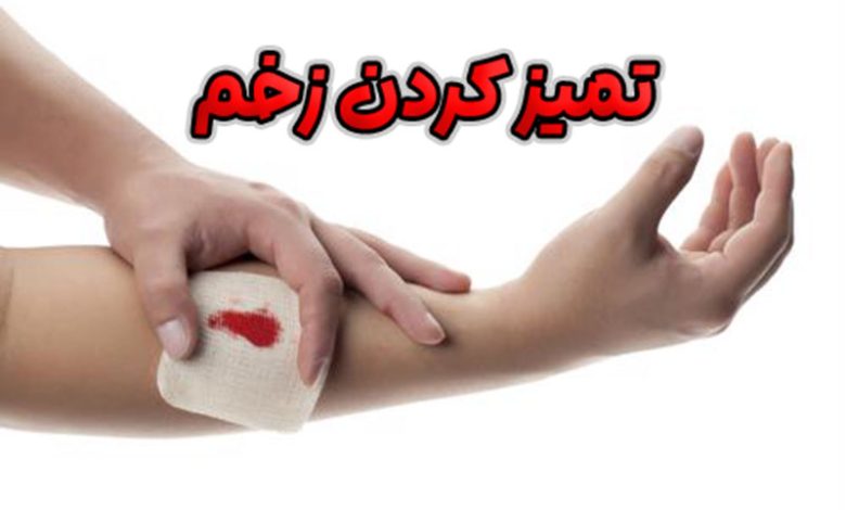 تمیز کردن زخم