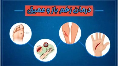 درمان زخم باز