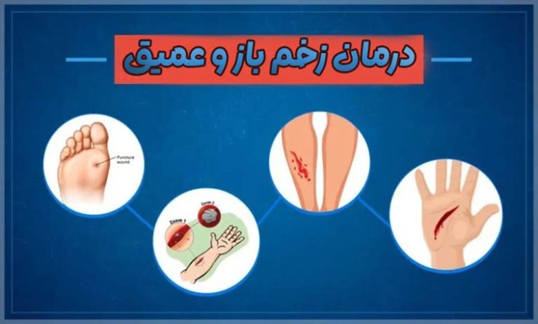 درمان زخم باز