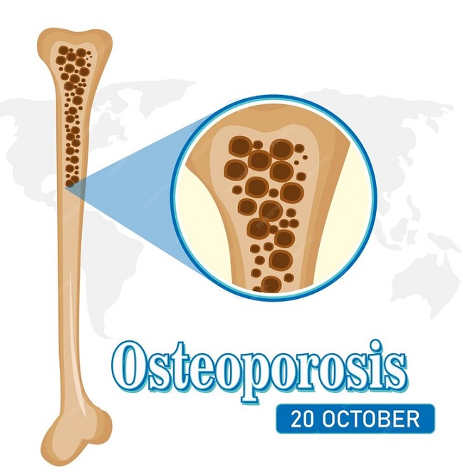 روش تشخیص استئومیلیت چگونه است