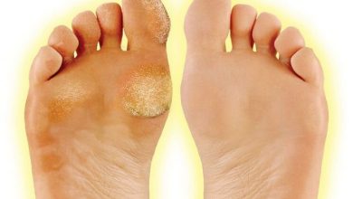 چگونه میتوانیم از پینه زخم پیشگیری کنیم