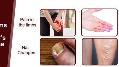 زخم بورگر دارای چه علائمی می باشد