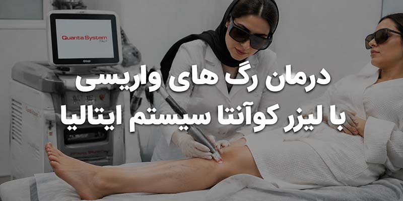 درمان-رگ-های-واریسی-با-لیزر-کوآنتا-سیستم درمان رگ های واریسی با لیزر کوآنتا سیستم