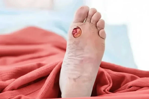 کلینیک زخم سوختگی و دیابتی پاسداران