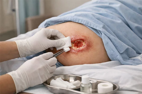 کلینیک زخم در غرب تهران 