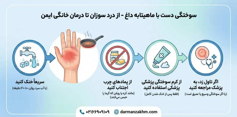 سوختگی دست با ظرف داغ