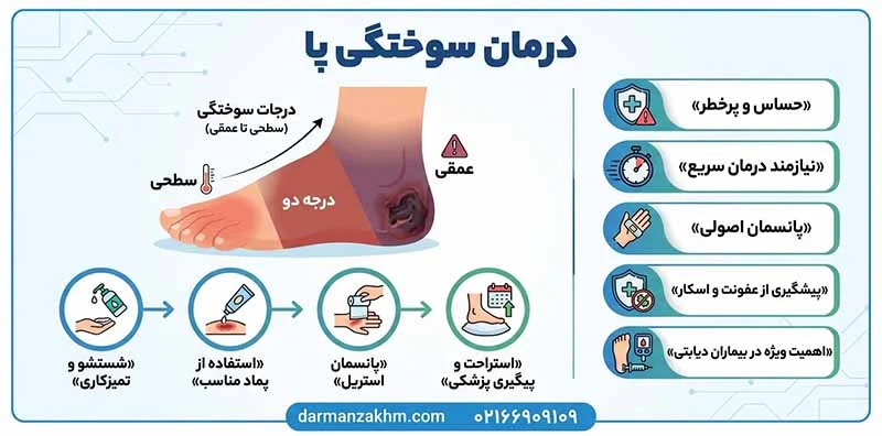 درمان سوختگی پا